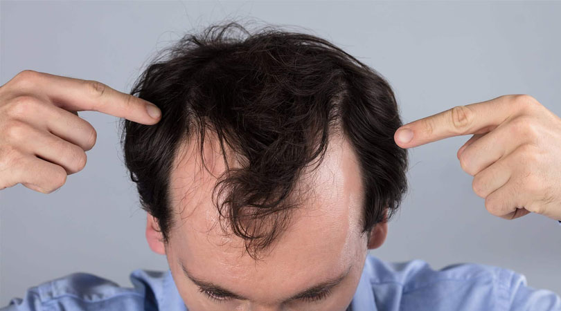 Jeukende hoofdhuid en haarverlies: Oorzaken, behandelingen en effectieve oplossingen